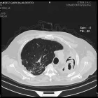 La imagen 3 de la Empresa CENTRO DE IMÁGENES HINOJOSA Radiología pediátrica en Arequipa ARE