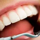 La imagen 3 de la Empresa CONSULTORIO ONTOLÓGICO PROFESIONAL DR. FLORES Periodoncista de implantes dentales en Lima LAM