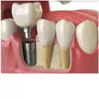 La imagen 2 de la Empresa DENTAL LITTLE KIDS Periodoncista de implantes dentales en Perú LAM