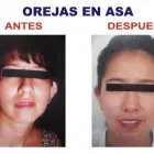La imagen 5 de la Empresa DR. JULIO MORÓN RODRÍGUEZ Cirugía Plástica en Miraflores Perú