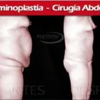 La imagen 7 de la Empresa INSTITUTO DE CIRUGÍA PLÁSTICA JORGE MORENO SAC Rinoplastía en Surco LAM