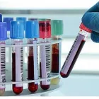 La imagen 6 de la Empresa LABORATORIO DE ANÁLISIS CLÍNICOS Y MICROBIOLÓGICOS SOLIDARIDAD Laboratorio de análisis clínicos en Cajamarca CAJ