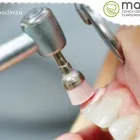 La imagen 3 de la Empresa MASANA CLÍNICA ODONTOLOGÍA Y COMPLEMENTARIA Periodoncia en Chiclayo Lambayeque