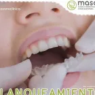 La imagen 4 de la Empresa MASANA CLÍNICA ODONTOLOGÍA Y COMPLEMENTARIA Periodoncia en Chiclayo Lambayeque