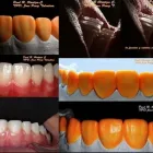 La imagen 1 de la Empresa O & G ODONTOLOGÍA INTEGRAL Periodoncista de implantes dentales en Piura PIU