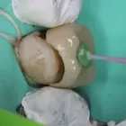 La imagen 3 de la Empresa O & G ODONTOLOGÍA INTEGRAL Periodoncista de implantes dentales en Piura PIU