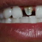 La imagen 4 de la Empresa O & G ODONTOLOGÍA INTEGRAL Periodoncista de implantes dentales en Piura PIU