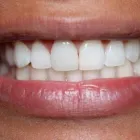 La imagen 5 de la Empresa O & G ODONTOLOGÍA INTEGRAL Periodoncista de implantes dentales en Piura PIU