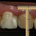 La imagen 6 de la Empresa O & G ODONTOLOGÍA INTEGRAL Periodoncista de implantes dentales en Piura PIU