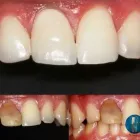 La imagen 9 de la Empresa O & G ODONTOLOGÍA INTEGRAL Periodoncista de implantes dentales en Piura PIU