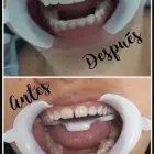 La imagen 10 de la Empresa O & G ODONTOLOGÍA INTEGRAL Periodoncista de implantes dentales en Piura PIU