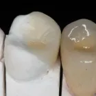 La imagen 12 de la Empresa O & G ODONTOLOGÍA INTEGRAL Periodoncista de implantes dentales en Piura PIU