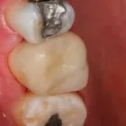 La imagen 13 de la Empresa O & G ODONTOLOGÍA INTEGRAL Periodoncista de implantes dentales en Piura PIU