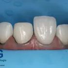 La imagen 14 de la Empresa O & G ODONTOLOGÍA INTEGRAL Periodoncista de implantes dentales en Piura PIU