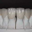La imagen 15 de la Empresa O & G ODONTOLOGÍA INTEGRAL Periodoncista de implantes dentales en Piura PIU