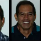 La imagen 16 de la Empresa O & G ODONTOLOGÍA INTEGRAL Periodoncista de implantes dentales en Piura PIU