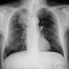 La imagen 2 de la Empresa RADIOGRAFIAS A DOMICILIO - DIAGNOSTICCENTER PERÚ Terapia Fisica y Rehabilatacion en Lima LAM