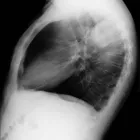 La imagen 3 de la Empresa RADIOGRAFIAS A DOMICILIO - DIAGNOSTICCENTER PERÚ Terapia Fisica y Rehabilatacion en Lima LAM