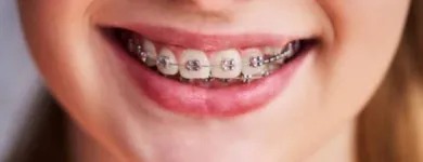 La imagen 5 de la Empresa CLÍNICA DENTAL SAN MARTÍN DE PORRES Ortodoncia en Lima LAM