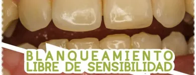 La imagen 2 de la Empresa MASANA CLÍNICA ODONTOLOGÍA Y COMPLEMENTARIA Periodoncia en Chiclayo Lambayeque