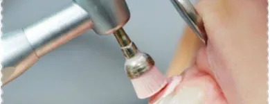 La imagen 3 de la Empresa MASANA CLÍNICA ODONTOLOGÍA Y COMPLEMENTARIA Periodoncia en Chiclayo Lambayeque
