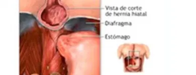 La imagen 3 de la Empresa PALOMINO TORRICO WILFREDO GUILLERMO Gastroenterologia en Arequipa ARE