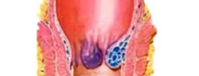 La imagen 4 de la Empresa PALOMINO TORRICO WILFREDO GUILLERMO Gastroenterologia en Arequipa ARE