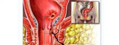 La imagen 5 de la Empresa PALOMINO TORRICO WILFREDO GUILLERMO Gastroenterologia en Arequipa ARE