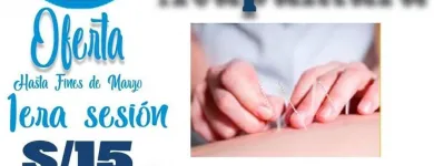 La imagen 4 de la Empresa TERAFINT QUIROPRAXIA Y ACUPUNTURA Quiropráctico en Lima LAM