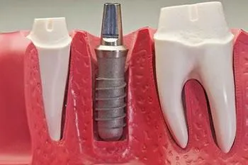 La imagen 1 de la Empresa FUTURE DENT