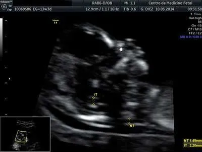 La imagen 1 de la Empresa CENTRO DE MEDICINA FETAL