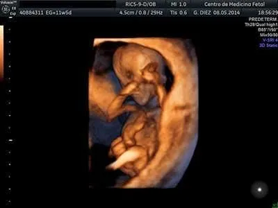 La imagen 2 de la Empresa CENTRO DE MEDICINA FETAL