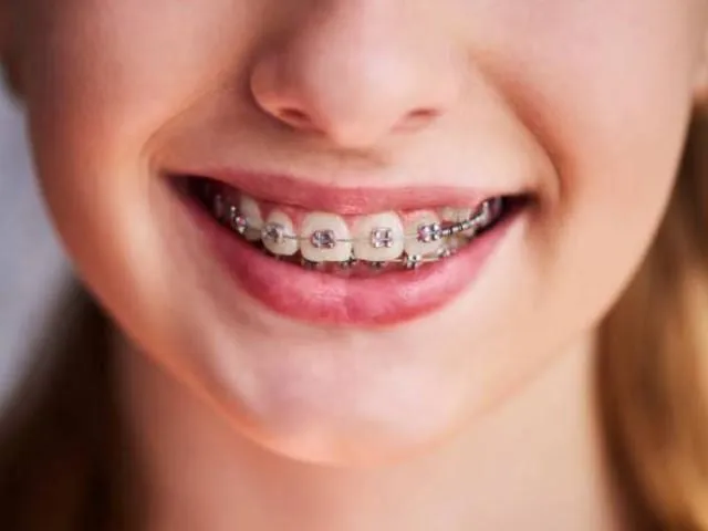 La imagen 5 de la Empresa CLÍNICA DENTAL SAN MARTÍN DE PORRES
